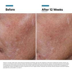 Hyaluronic Acid Intensifier (H.A.)
