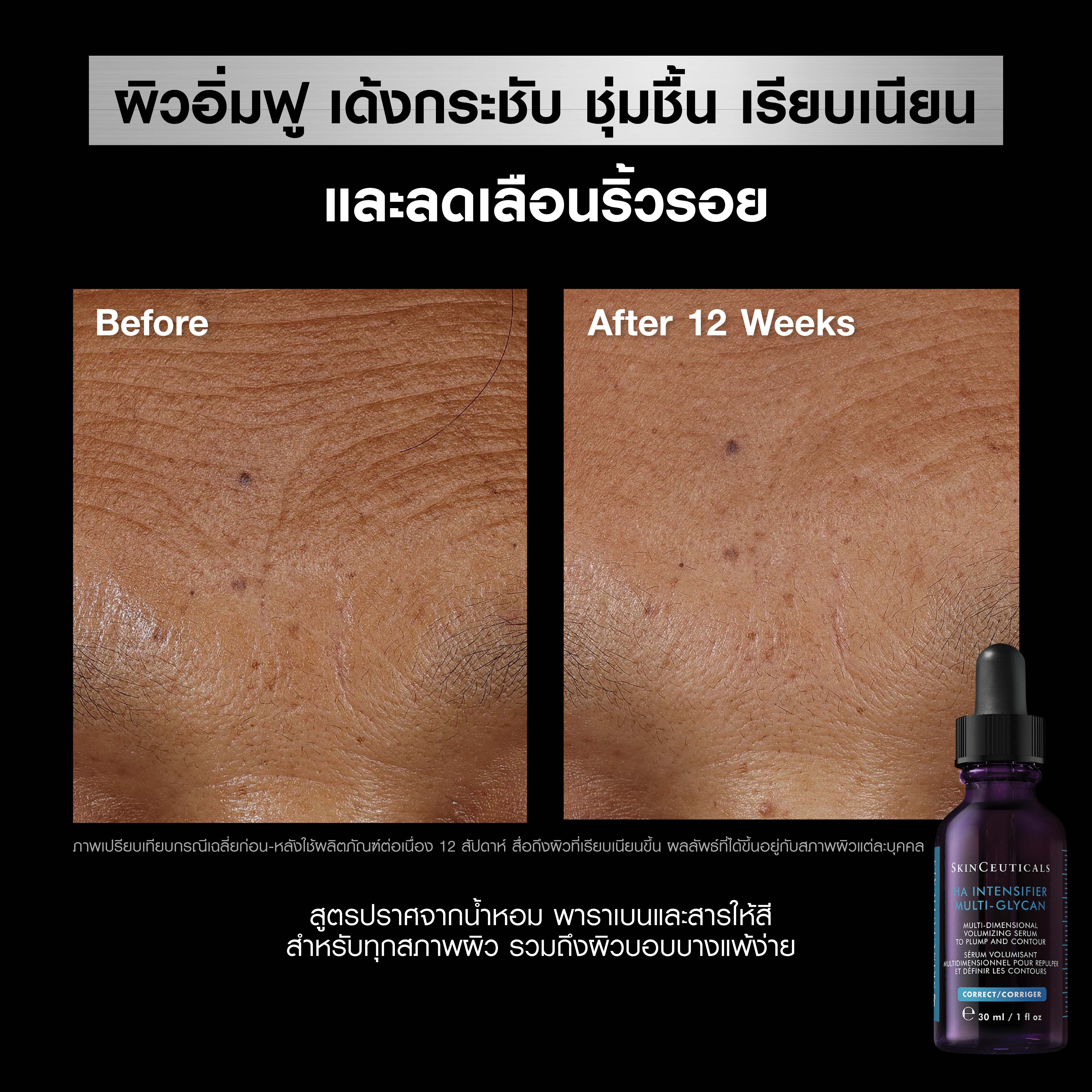 Hyaluronic Acid Intensifier Multi-Glycan​