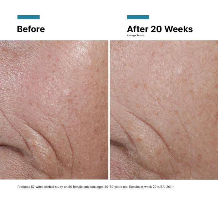 Before and after image