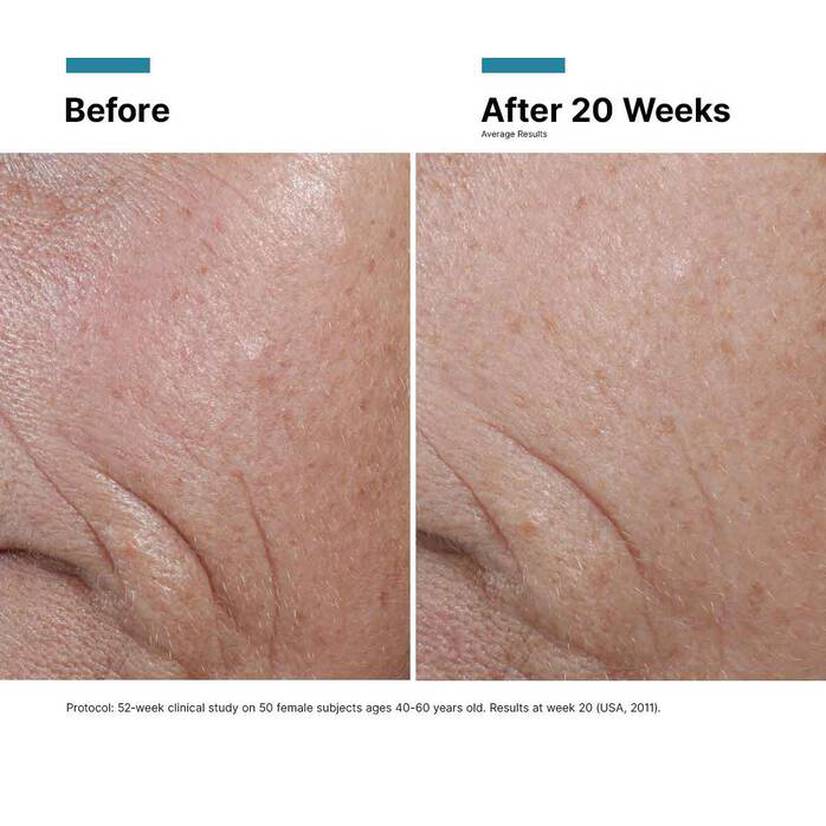 Before and after image