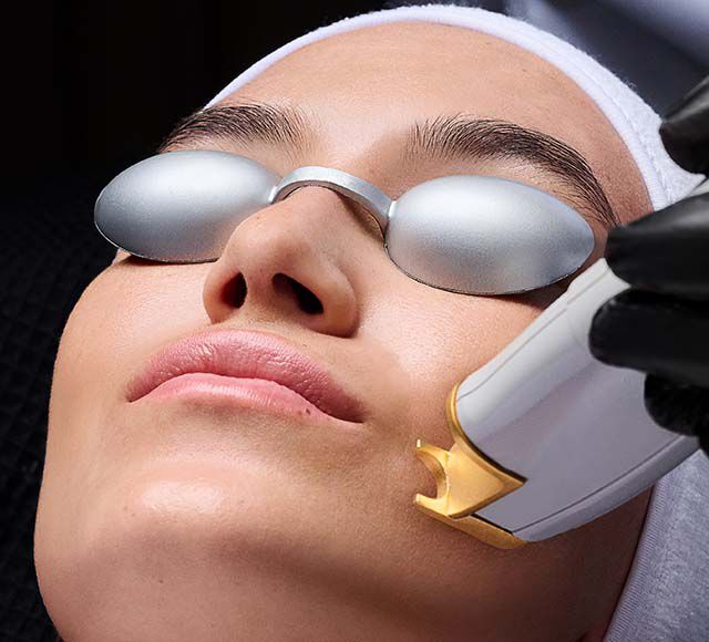 non ablative laser