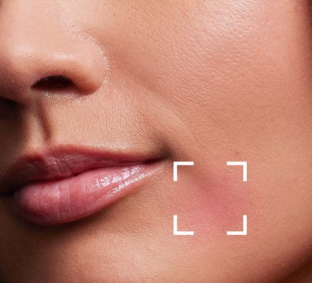 Corrective moisturizers