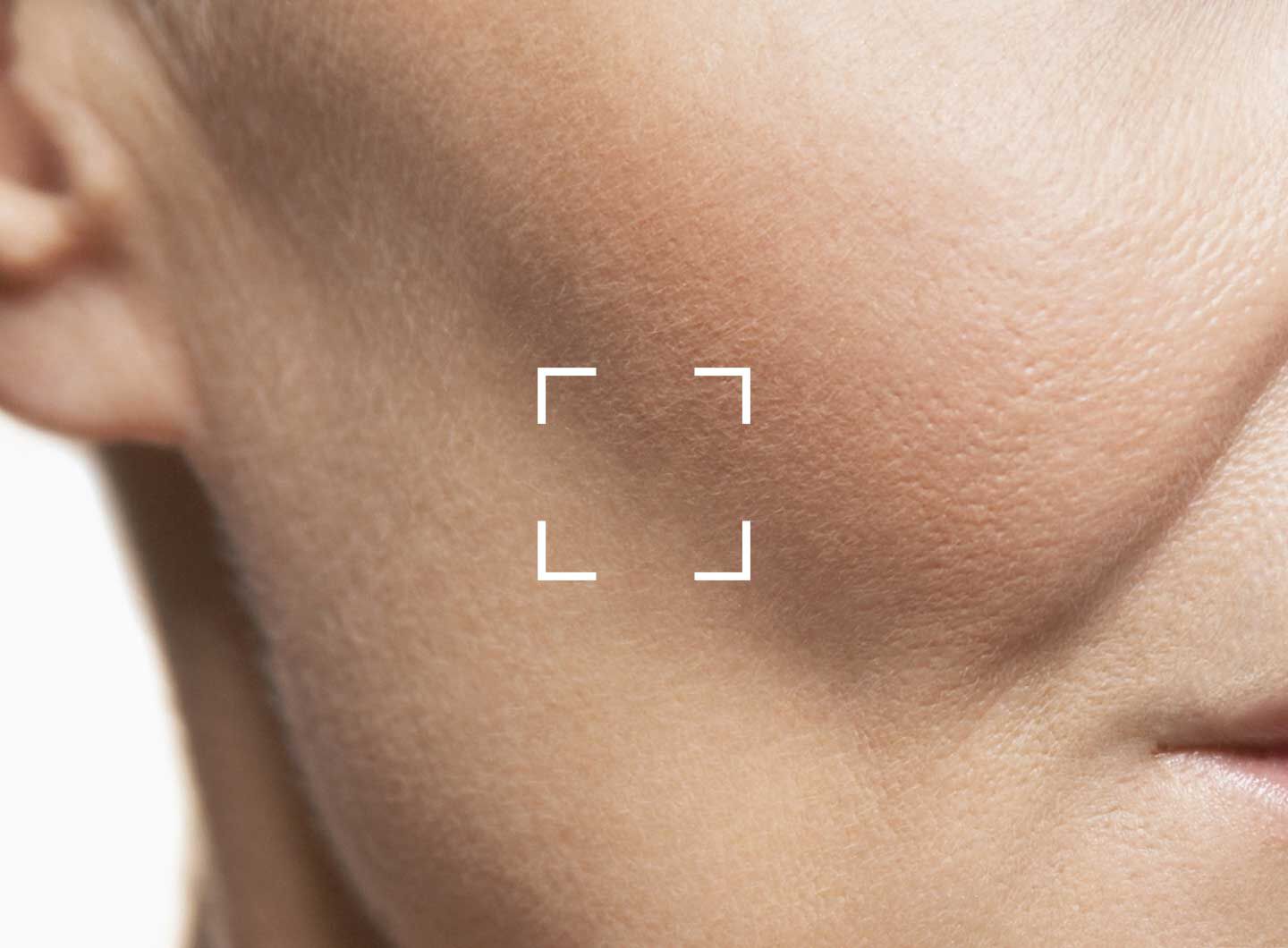 Facial Volume Loss Banner