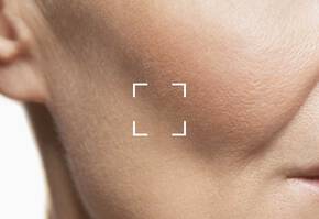 Facial Volume Loss Banner