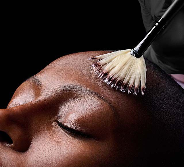 Light Chemical Peel Banner