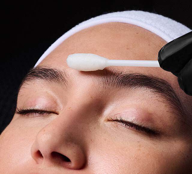 Deep Chemical Peel Banner
